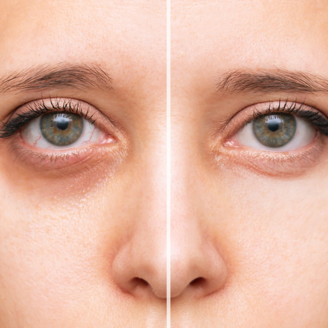 Eternal Under Eye Serum